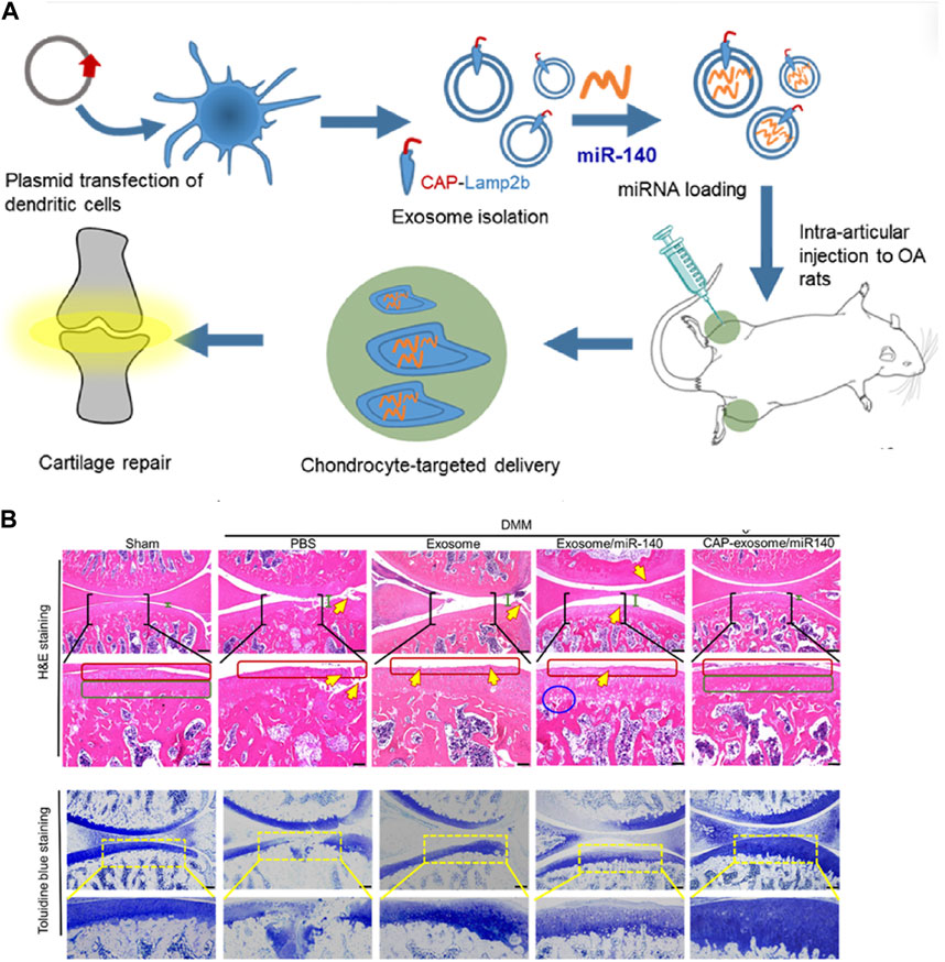 圖3：MSC-Exos藥物輸送用于OA治療的代表性研究。