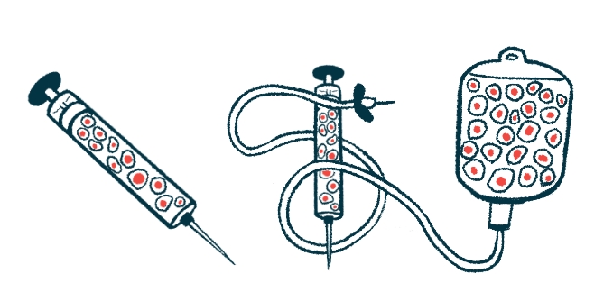 免疫調(diào)節(jié)性Tregs增強干細(xì)胞治療帕金森病的研究 免疫調(diào)節(jié)性Tregs增強干細(xì)胞治療帕金森病的研究