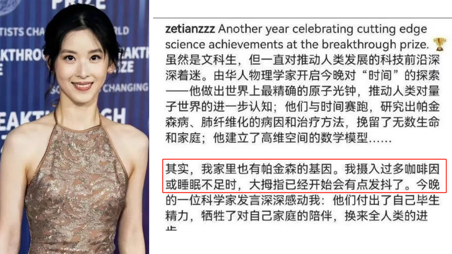 章澤天自曝有帕金森病家族史，干細胞療法讓年輕人不再懼“帕”