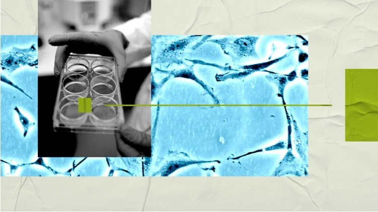 研究人員稱，大腦研究可能有助于開發(fā)新的精神分裂癥治療方法。