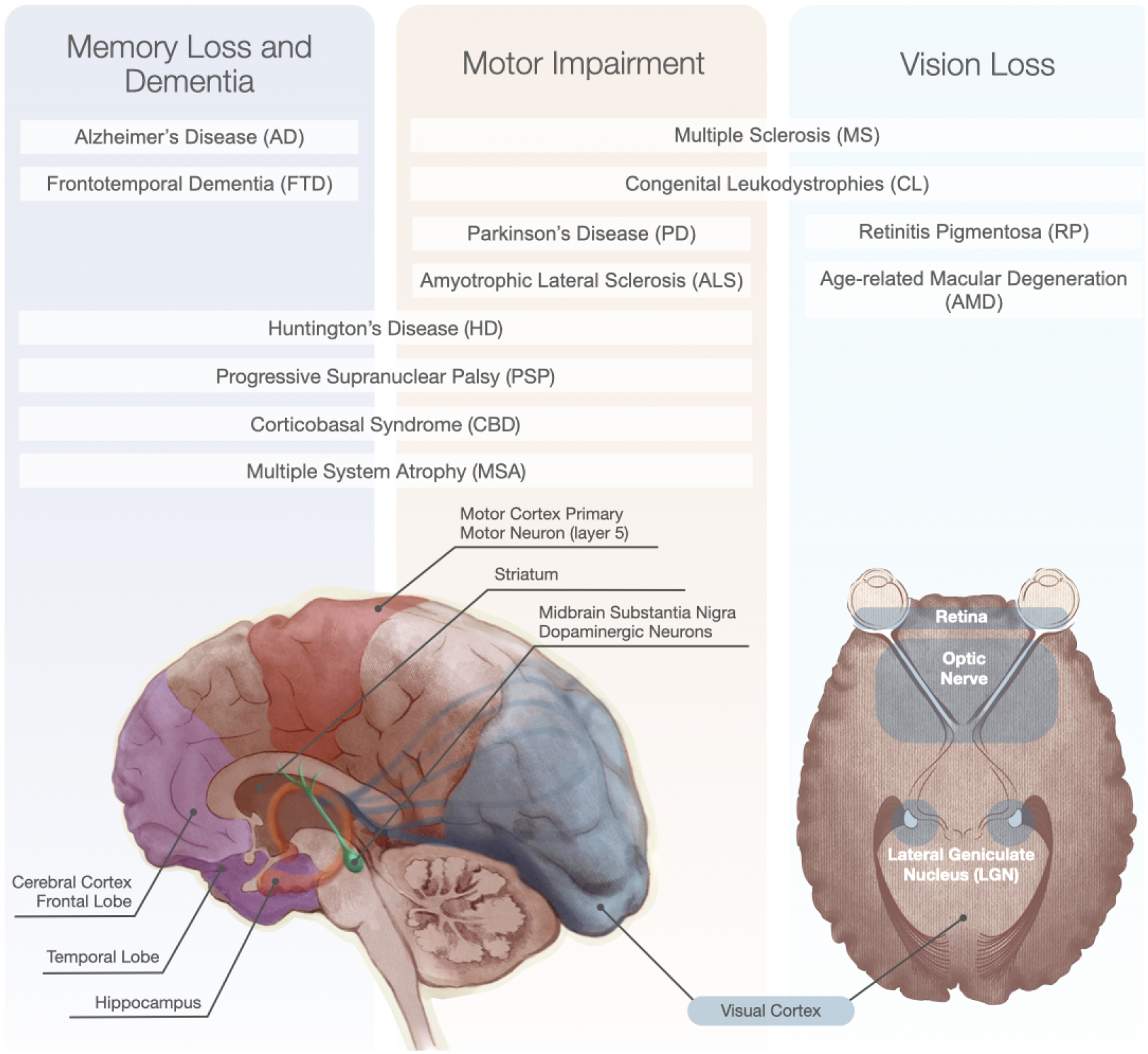 圖1：神經(jīng)退行性疾病和受影響的大腦區(qū)域的主要功能影響。