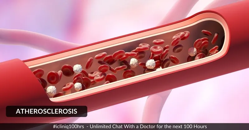 動脈粥樣硬化的體征和癥狀是什么？治療方案有哪些？