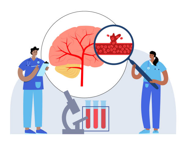 圍產(chǎn)期中風(fēng)-類型、原因和風(fēng)險因素