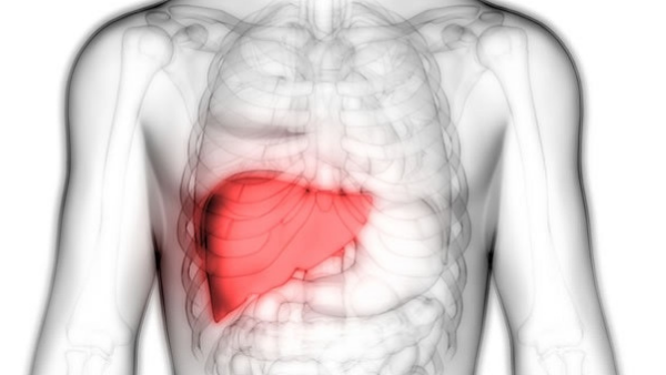 面對(duì)肝衰竭，你知道如何選擇最佳治療方案嗎？