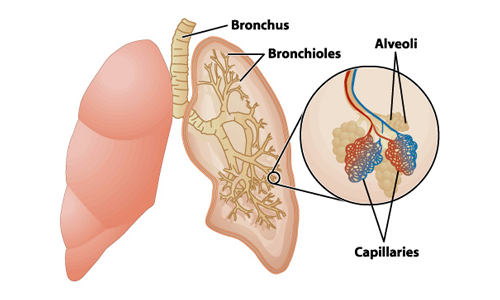 慢性阻塞性肺病如何影響肺部？