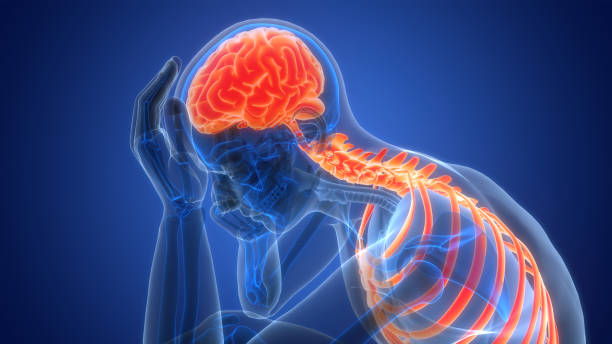 什么是缺血性腦中風(fēng)，癥狀、原因、診斷和治療