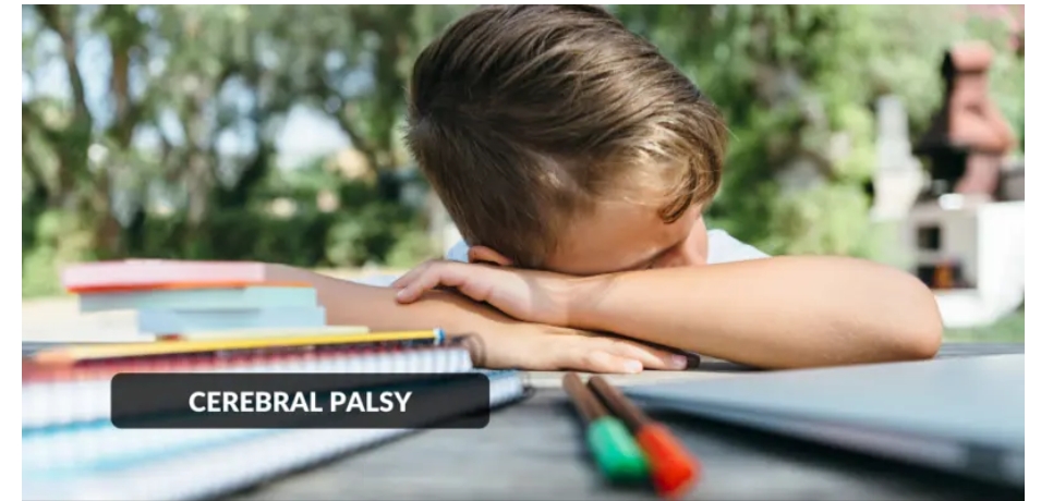 腦癱-原因、癥狀、類型和治療方法