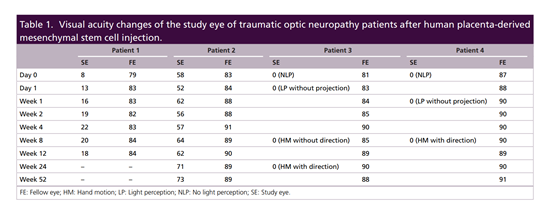 2021年干細(xì)胞治療神經(jīng)病變臨床案例 2021年干細(xì)胞治療神經(jīng)病變臨床案例