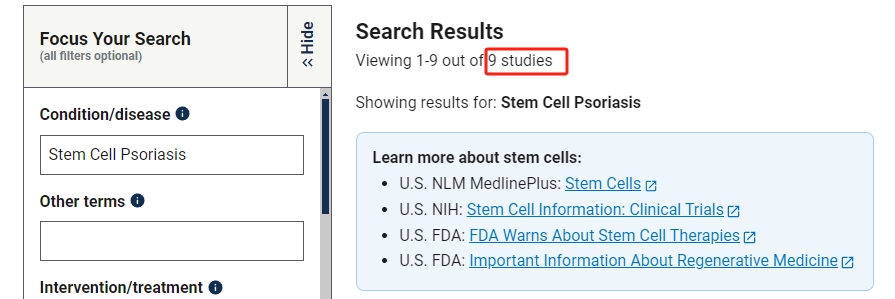 干細胞治療銀屑病的臨床研究進展 干細胞治療銀屑病的臨床研究進展