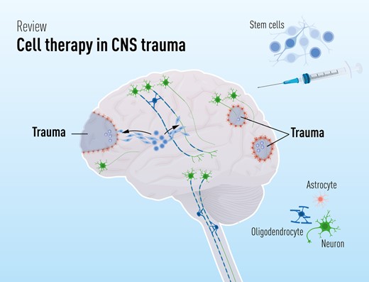 干細(xì)胞療法修復(fù)中樞神經(jīng)系統(tǒng)創(chuàng)傷：4個原則—什么、何時、何地和為什么