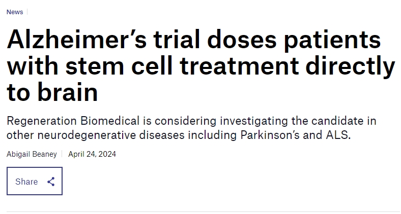 阿爾茨海默氏癥試驗(yàn)將干細(xì)胞直接注入患者大腦