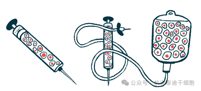 帕金森今日新聞：研究表明，低劑量TED-A9細(xì)胞療法可緩解帕金森病的運(yùn)動癥狀
