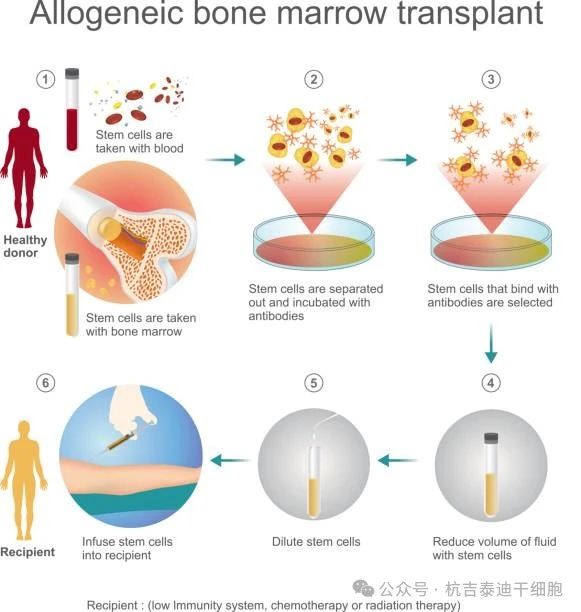 干細(xì)胞移植治療需要多長時間？