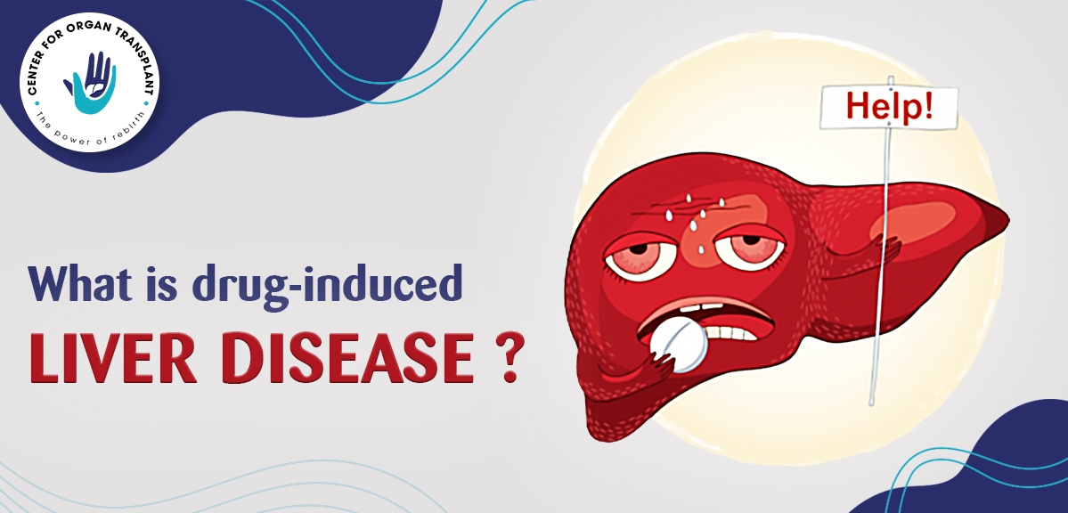 什么是藥物性肝衰竭-癥狀、原因和治療