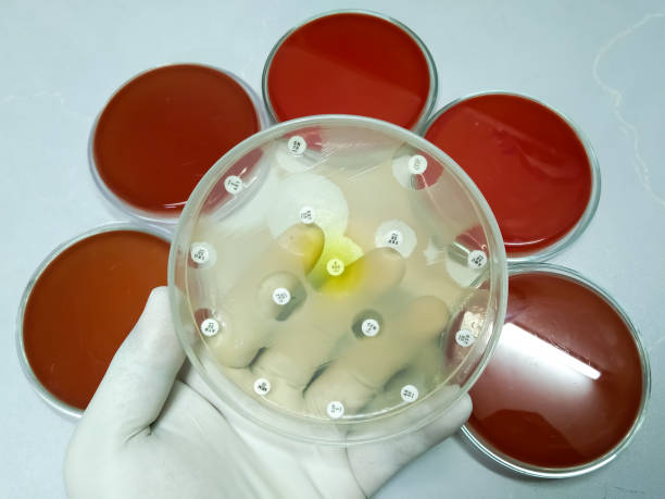 骨髓移植成功率100％嗎？