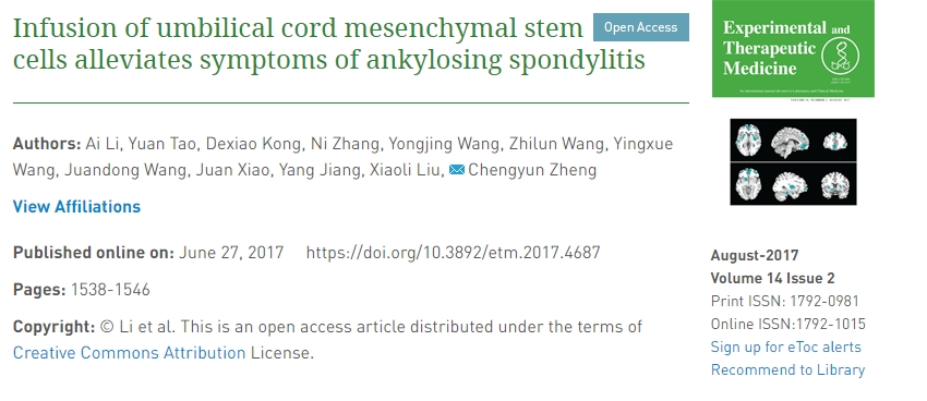 輸注臍帶間充質(zhì)干細(xì)胞可緩解強直性脊柱炎癥狀