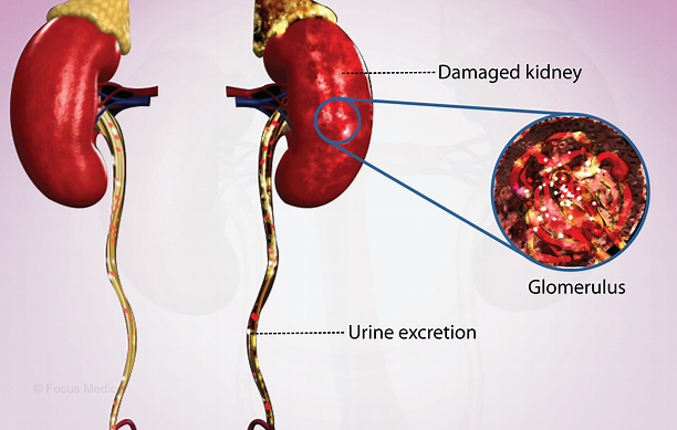 近10年國(guó)內(nèi)進(jìn)行干細(xì)胞治療急性腎損傷臨床研究的醫(yī)院有哪些？