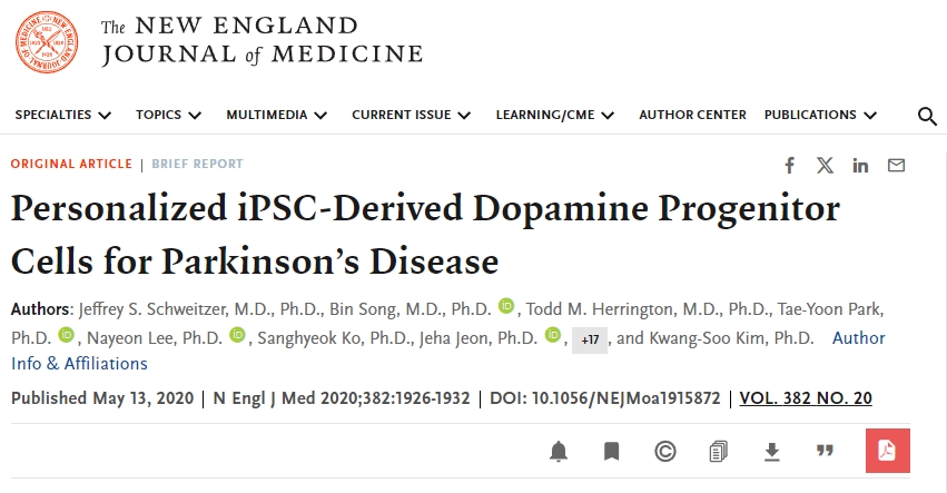 個(gè)性化 iPSC 衍生的多巴胺祖細(xì)胞用于治療帕金森病