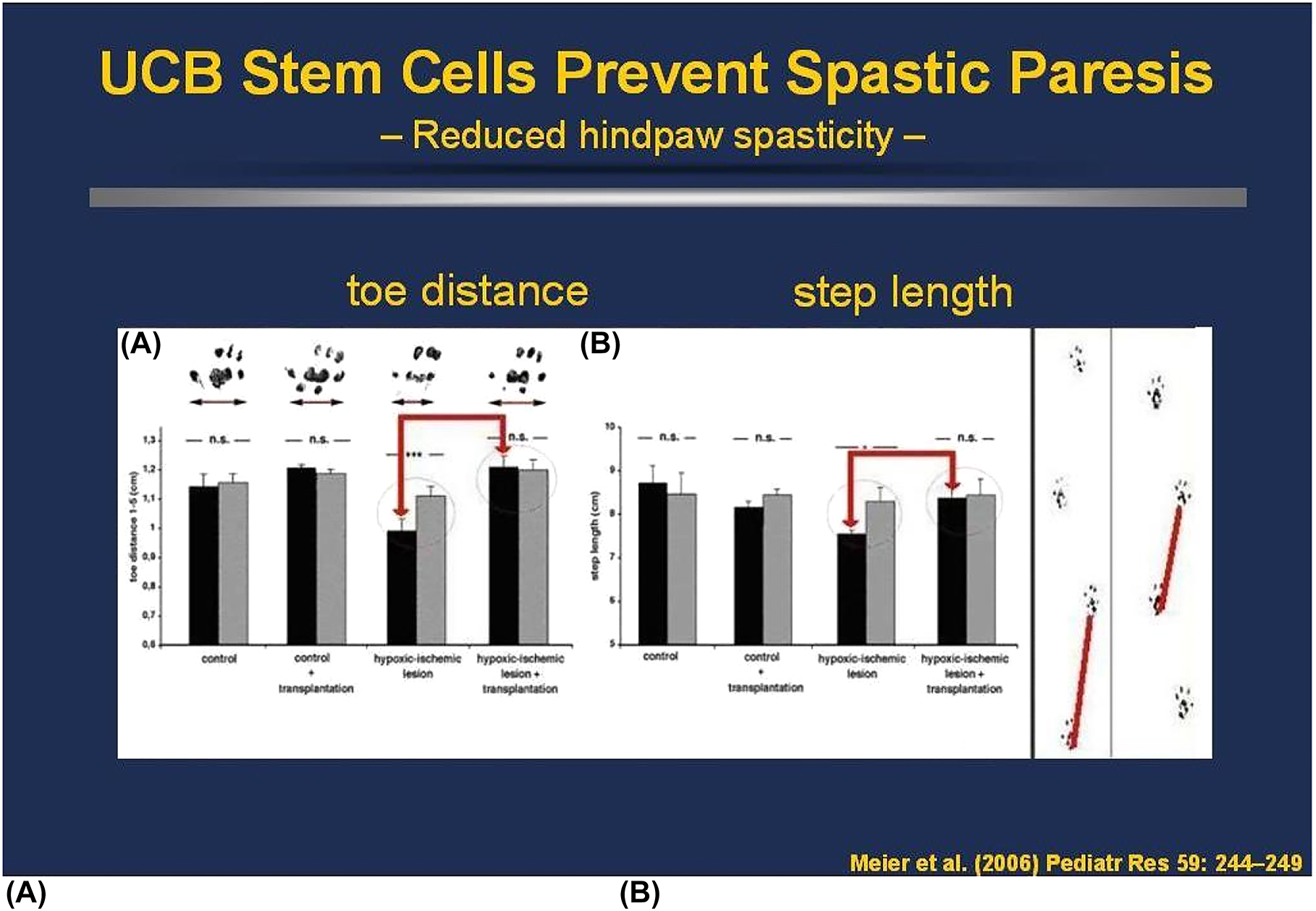 人類臍帶血MNC可預(yù)防PN7新生大鼠模型的痙攣性輕癱