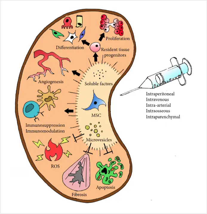 干細(xì)胞如何治療腎臟疾?。? class=