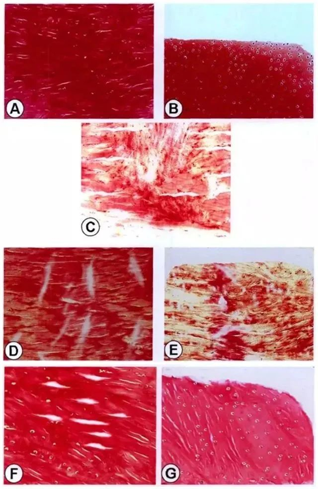 不同時(shí)間點(diǎn)修復(fù)組織紅-紅區(qū)與白-白區(qū)II型膠原表達(dá)量
