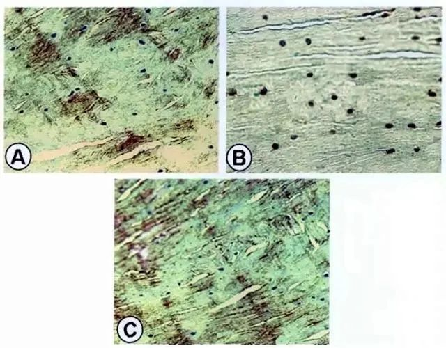 A為紅-紅區(qū)修復(fù)組織II型膠原的表達(dá)；B為紅-紅區(qū)修復(fù)組織S-100蛋白表達(dá)；C為紅-紅區(qū)修復(fù)組織I型膠原表達(dá)。