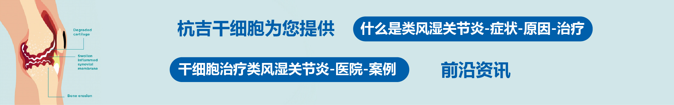 國內(nèi)外干細(xì)胞醫(yī)院治療類風(fēng)濕關(guān)節(jié)炎的臨床案例