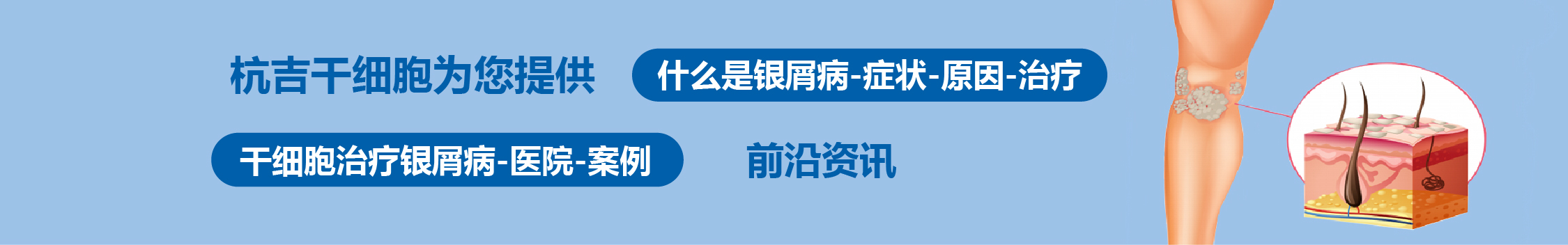 國內(nèi)外干細胞醫(yī)院治療銀屑病的臨床案例