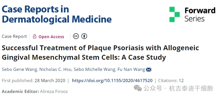 同種異體牙齦間充質(zhì)干細(xì)胞成功治療斑塊性銀屑病：案例研究