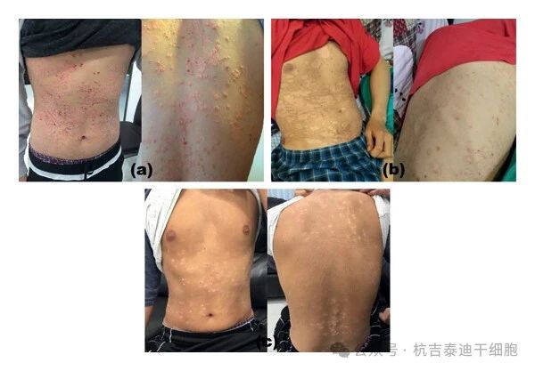 患者治療前后的對比圖