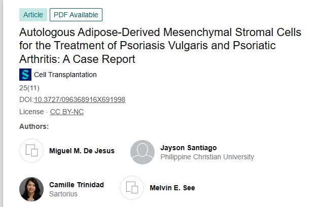 《自體脂肪來源的間充質(zhì)基質(zhì)細(xì)胞治療尋常型銀屑病和銀屑病關(guān)節(jié)炎：病例報(bào)告》