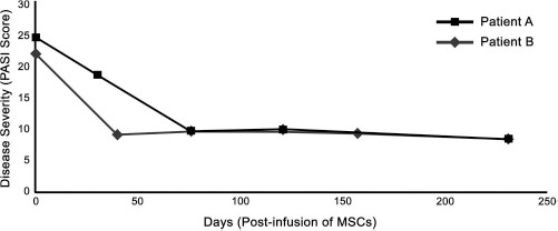 圖 1?. 移植 MSCs 前后兩例患者的銀屑病面積和嚴(yán)重程度指數(shù) (PASI) 評(píng)分總結(jié)。在輸注 MSCs 后的隨訪中，每例患者的 PASI 評(píng)分均有所下降。評(píng)分由第三方皮膚科醫(yī)生進(jìn)行。臨床改善持久，患者 A 的改善持續(xù)超過 150 天，患者 B 的改善持續(xù)超過 200 天。