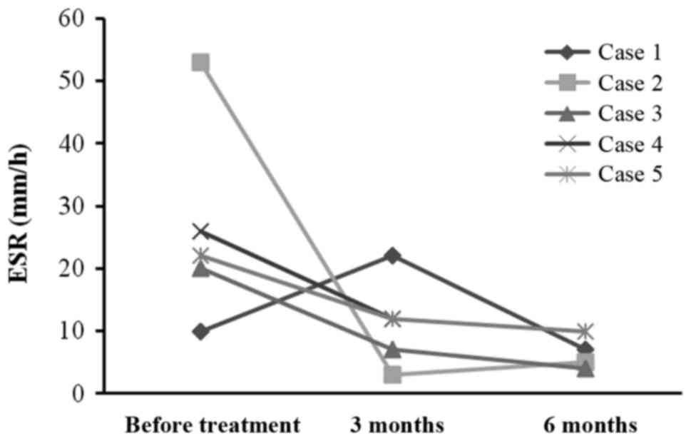 每位患者治療前后的 CRP 水平。1 名患者的 CRP 水平降低，而其他 4 名患者的 CRP 水平保持穩(wěn)定并在正常范圍內(nèi)。CRP，C 反應(yīng)蛋白。