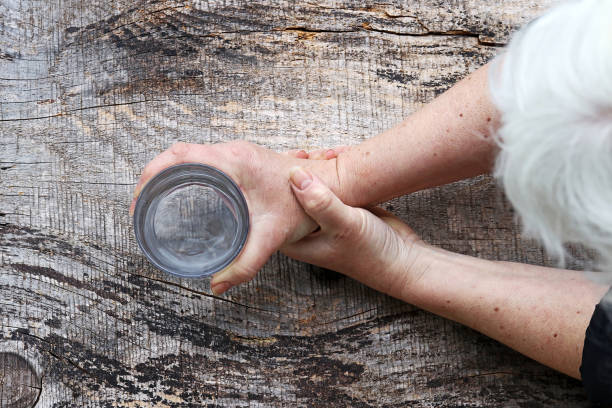 治療帕金森病的方案有那5大種？目前干細胞治療帕金森病前景如何？