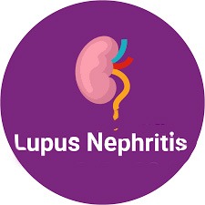 南京鼓樓醫(yī)院：干細(xì)胞治療92例狼瘡性腎炎，效果顯著！