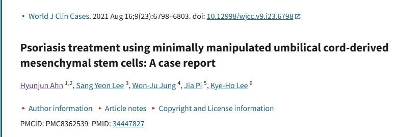 使用微操作臍帶來源的間充質(zhì)干細(xì)胞治療銀屑?。翰±龍?bào)告