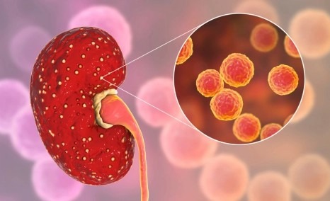 干細(xì)胞治療狼瘡性腎炎的安全性怎么樣？盤點(diǎn)國(guó)內(nèi)外臨床進(jìn)展！