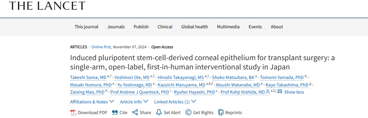 《誘導(dǎo)性多能干細(xì)胞來源的角膜上皮用于移植手術(shù)：日本的一項(xiàng)單臂、開放標(biāo)簽、首次人體介入研究》