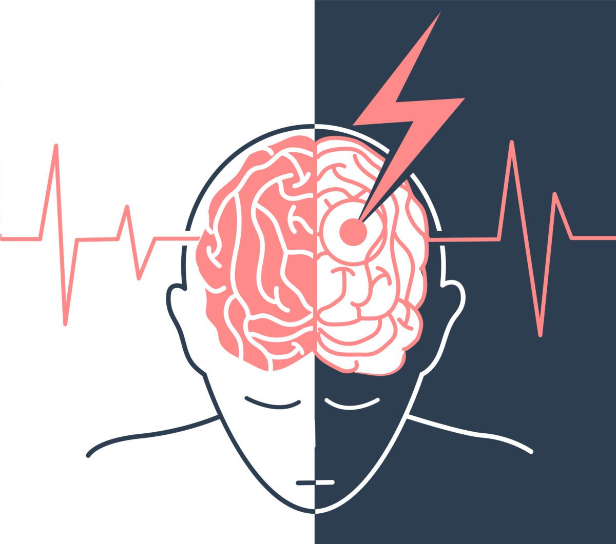 宣武醫(yī)院發(fā)布：間充質(zhì)干細胞治療中風，可以改善患者神經(jīng)功能障礙