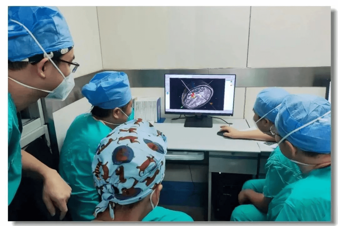 立體定向引導(dǎo)下神經(jīng)干細胞移植術(shù) 立體定向引導(dǎo)下神經(jīng)干細胞移植術(shù)