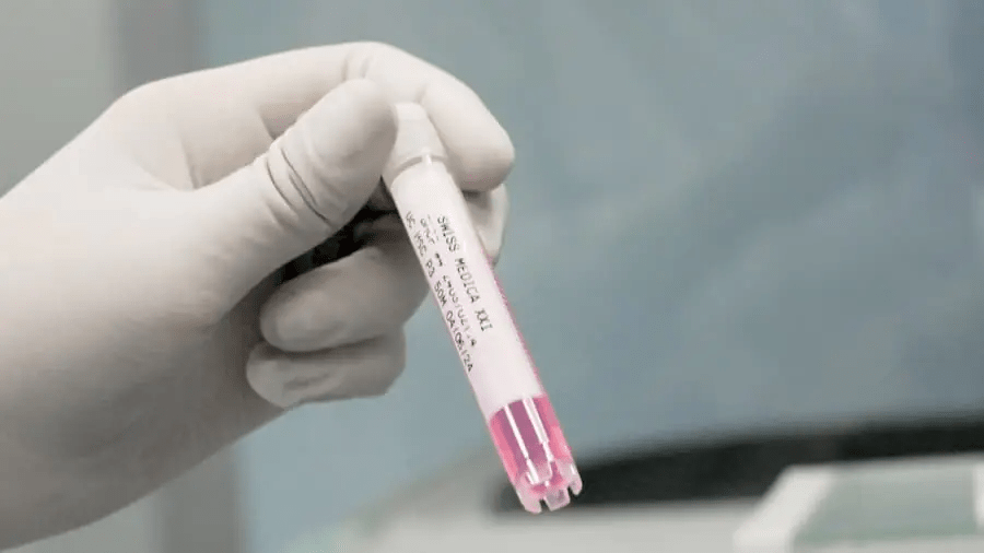 干細胞治療程序：??完整流程和所有步驟！