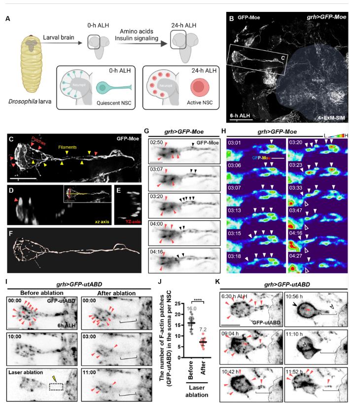 圖2:靜息態(tài)神經(jīng)干細胞再激活過程中的F-肌動蛋白結(jié)構(gòu)和動力學 圖2:靜息態(tài)神經(jīng)干細胞再激活過程中的F-肌動蛋白結(jié)構(gòu)和動力學