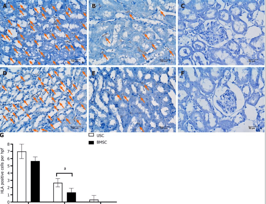 圖5：通過人類白細(xì)胞抗原免疫染色檢測急性腎損傷小鼠腎臟內(nèi)的尿液干細(xì)胞或骨髓間充質(zhì)干細(xì)胞