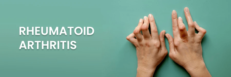 2024年最新進展報告:干細胞療法為類風濕關(guān)節(jié)炎帶來希望之光 2024年最新進展報告:干細胞療法為類風濕關(guān)節(jié)炎帶來希望之光