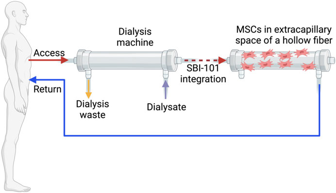 圖1：配備集成SBI-101系統(tǒng)的體外回路。