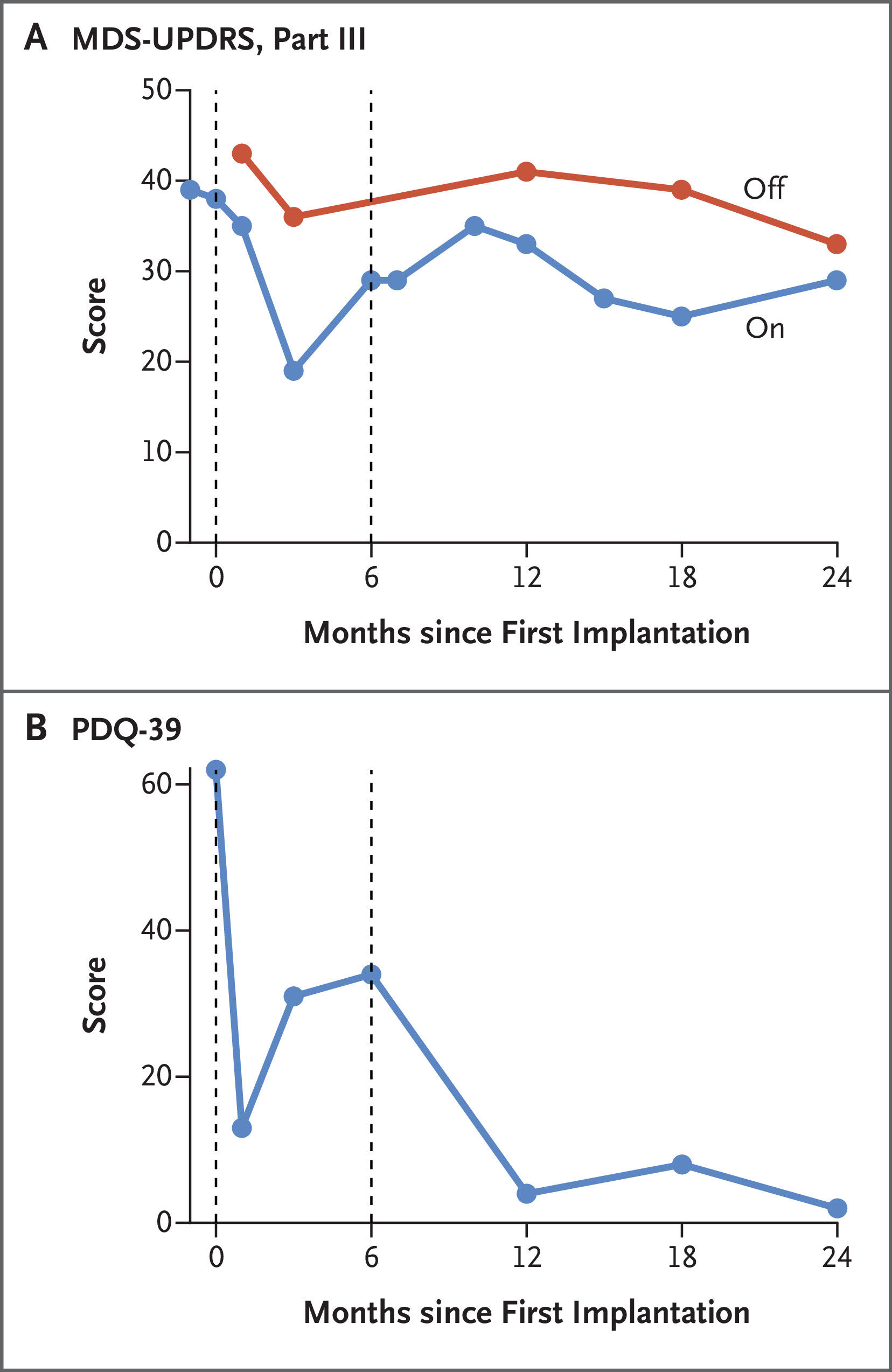 帕金森病相關(guān)運(yùn)動功能和生活質(zhì)量的縱向臨床評估