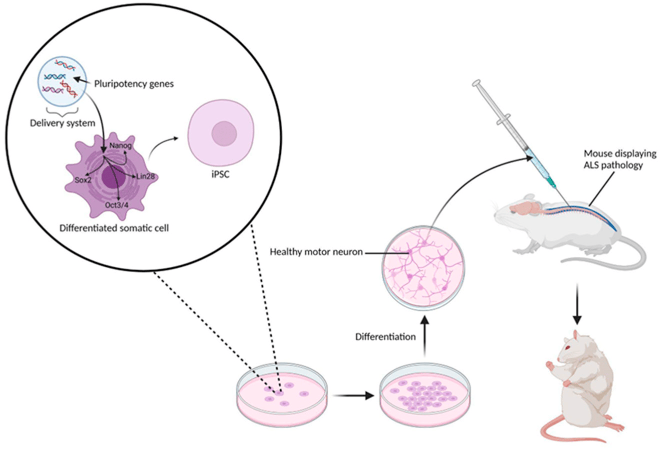 圖4：涉及移植iPSC衍生NSC的典型臨床前實(shí)驗(yàn)方案