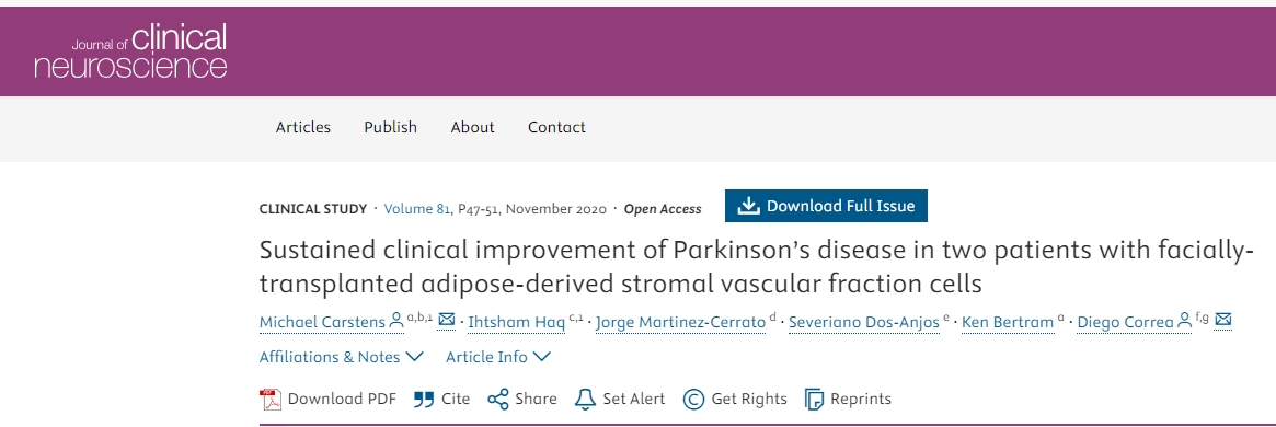 面部移植間充質(zhì)干細胞治療2例帕金森病患者，患者臨床癥狀持續(xù)改善