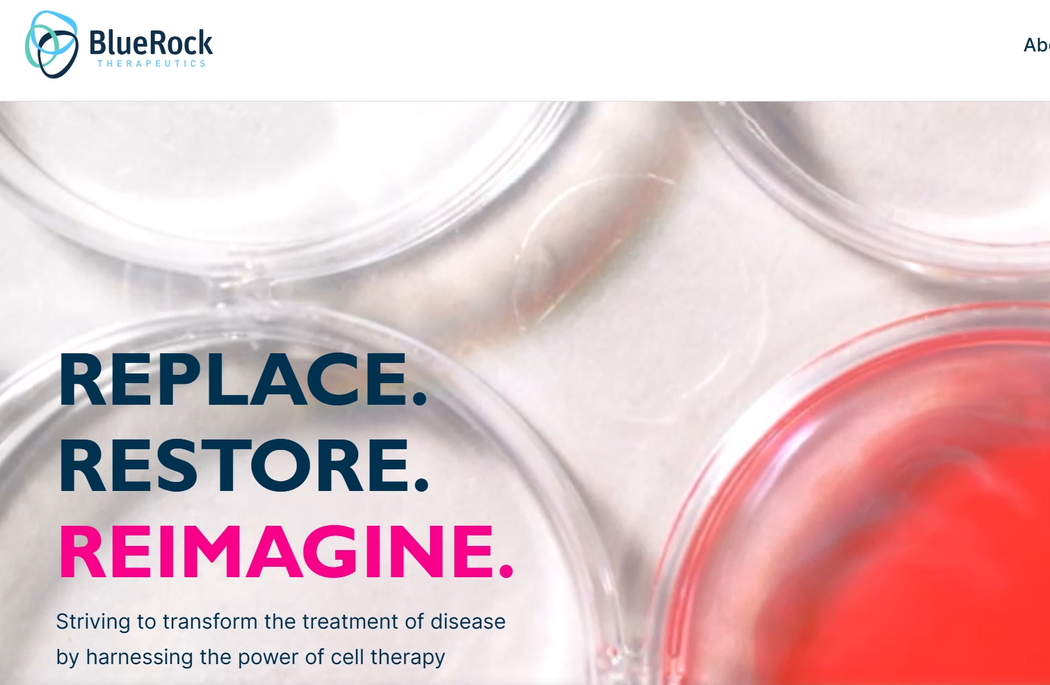 拜耳突破性干細(xì)胞治療帕金森病III期臨床試驗(yàn)啟動(dòng)，開(kāi)啟治療新紀(jì)元！