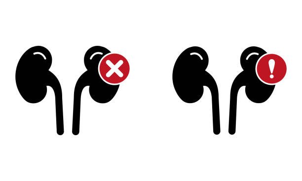 探索干細胞療法：能否成為降低腎病患者肌酐水平的新希望？